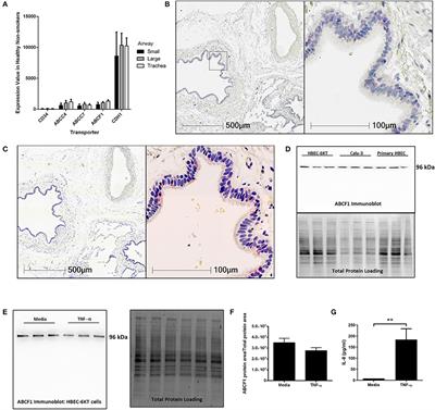 ABCF1 Regulates dsDNA-induced Immune Responses in Human Airway Epithelial Cells